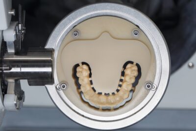 Close up of digital dentures being printed